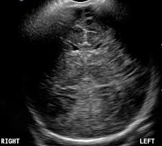 Ultrasound Body and Cranial